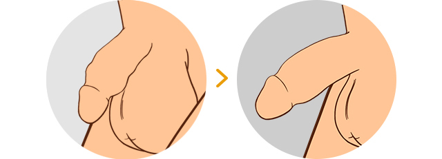 결과 불만족/흡수/추가확대