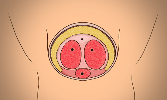 지방이 음경을 감싼 단면도 입니다.